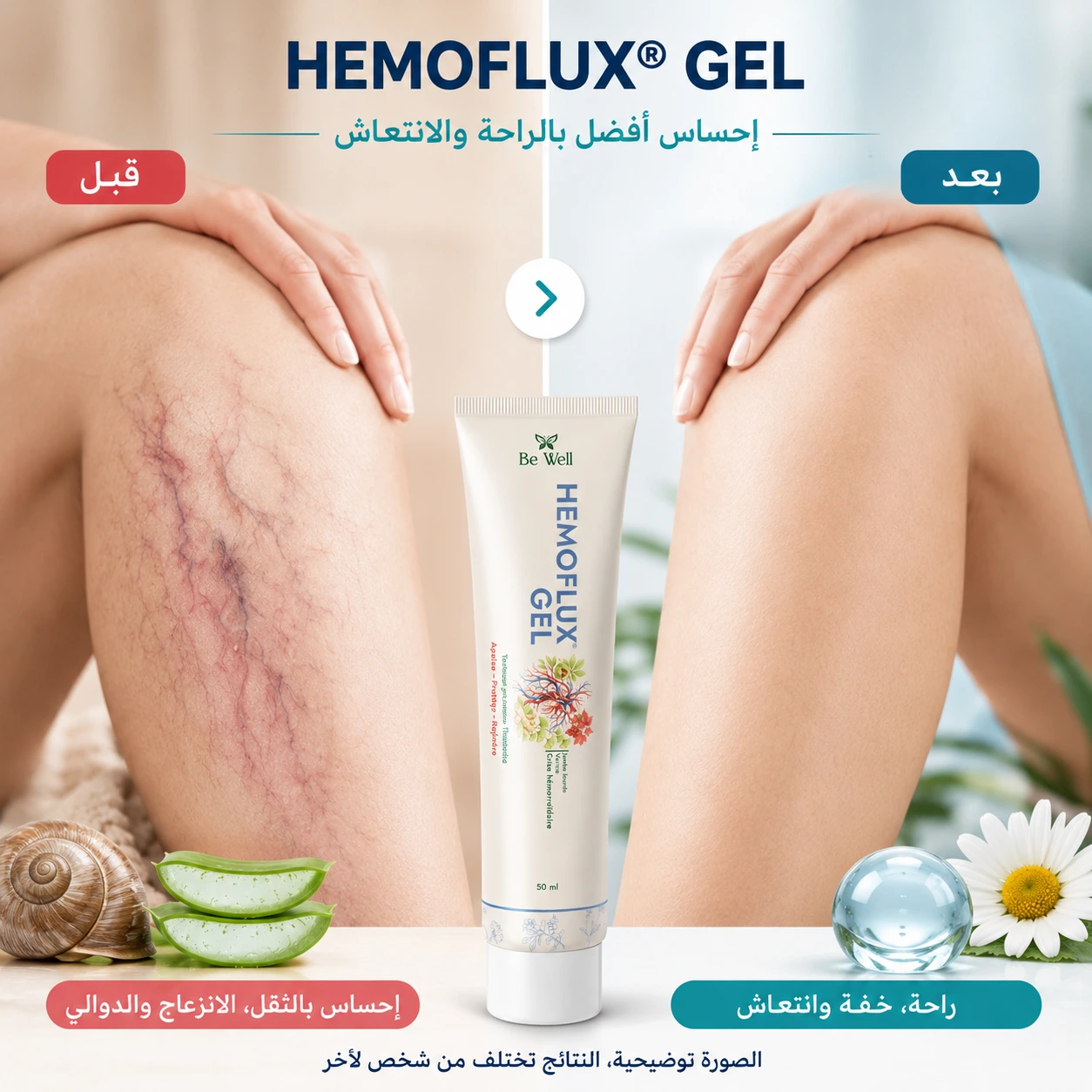 تصوير توضيحي قبل وبعد استعمال HEMOFLUX GEL